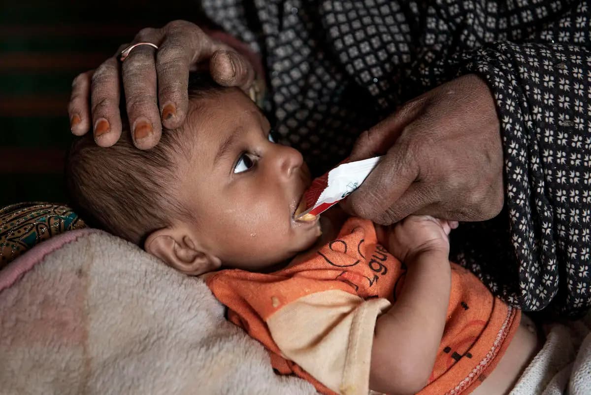 malnutrition afghans crisis